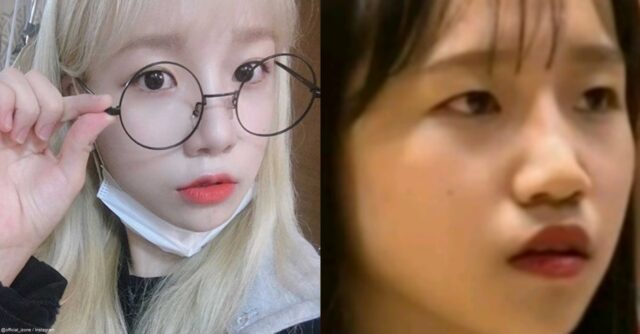 チョユリの鼻は整形？昔と今の顔の違いを徹底比較！